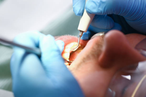 Best Dentist for Tooth Abscess  in Norfolk, NE