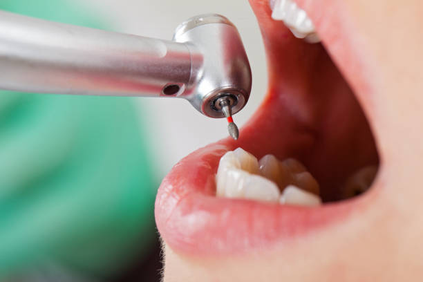 Tooth Infection Emergency Dentist in NE